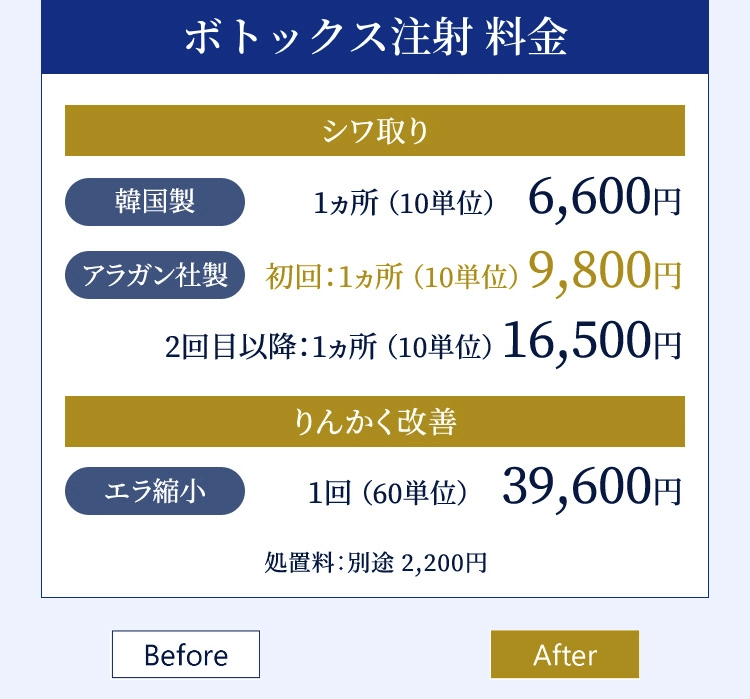 ボトックス注射 料金